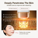 ANLAN RF Beauty Device
